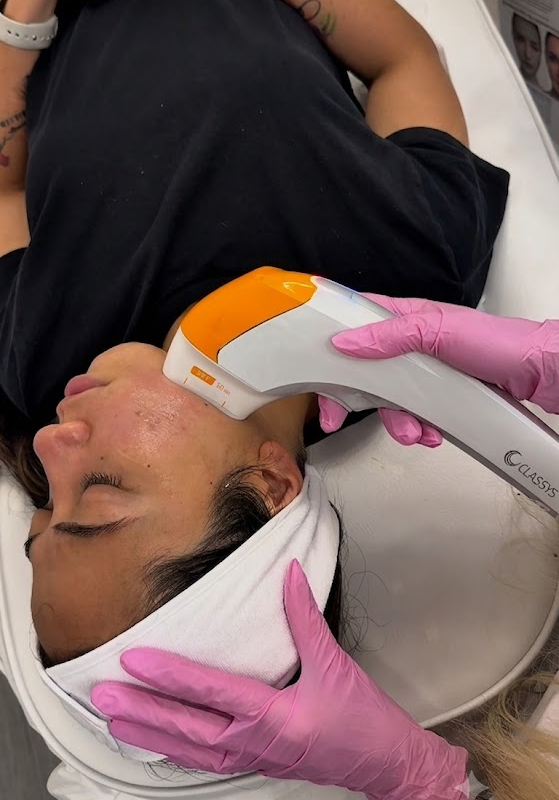 patient receiving hifu mpt treatment